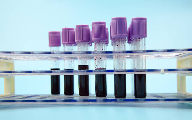 Blood collection tube