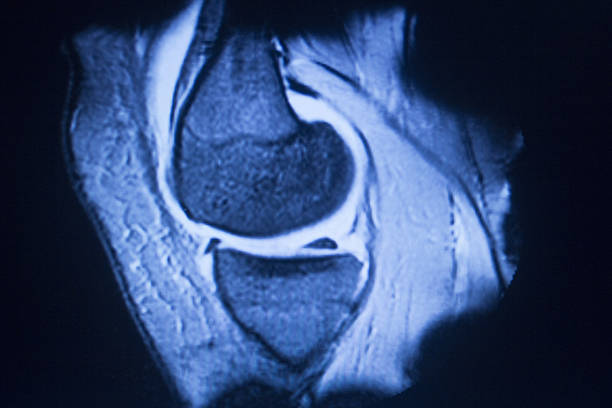 istock MRI magnetic resonance imaging medical scan 502396502