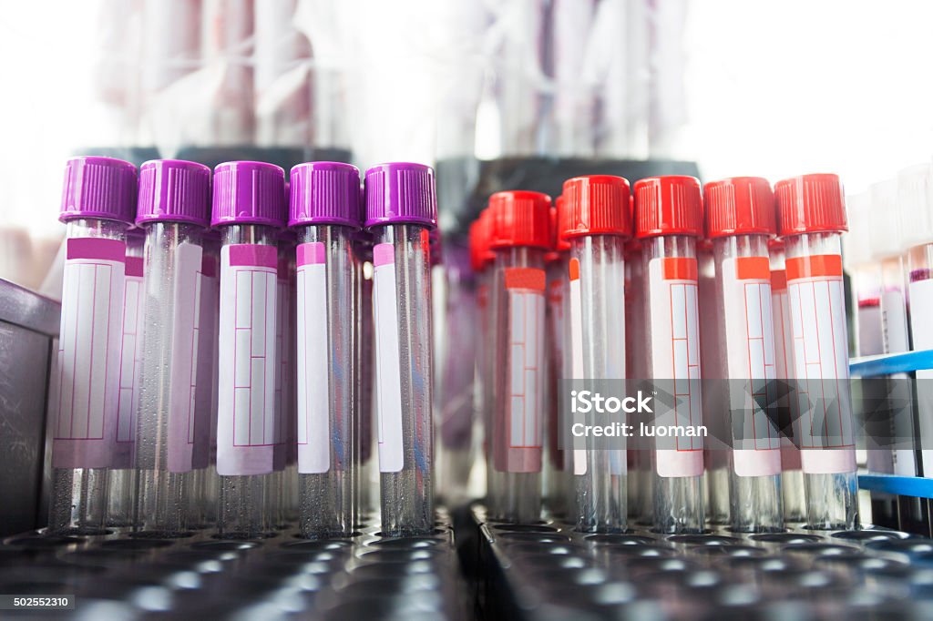 Blood test - sample Blood Stock Photo