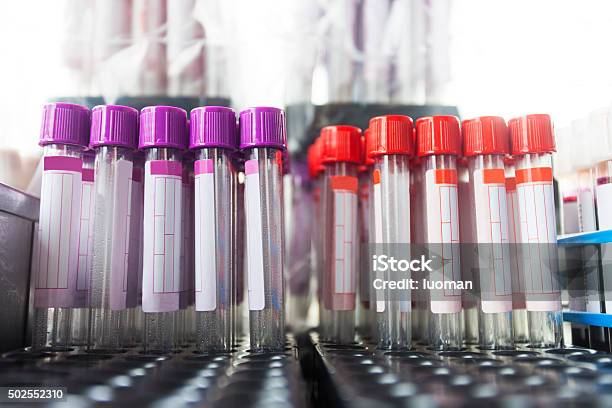 Blood Test Sample Stock Photo - Download Image Now - Blood, Laboratory, Medical Sample