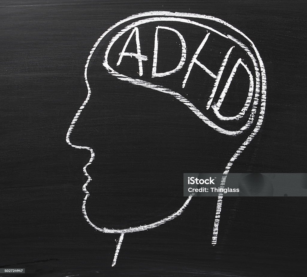 ADHD Concept A human head drawn on a blackboard with the letters ADHD which stand for Attention Deficit Hyperactivity Disorder in the brain area Alertness Stock Photo