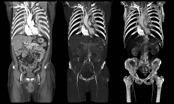 gli organi interni in ct scansioni - human vertebra foto e immagini stock