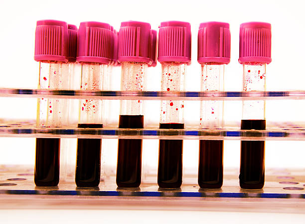 Blood collection tube