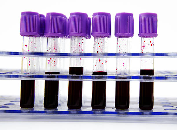 istock Blood collection tube 502752941