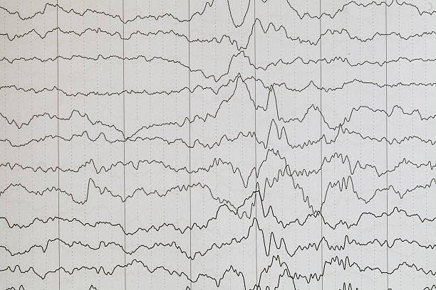 gehirn wave - eeg epilepsy science electrode stock-fotos und bilder