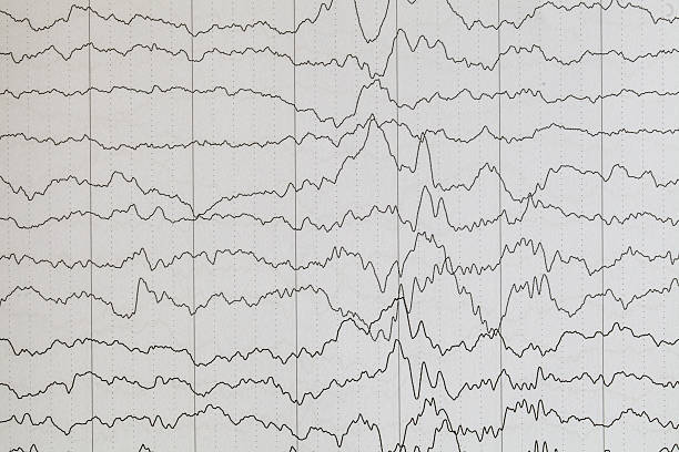 cervello onda - eeg epilepsy science electrode foto e immagini stock