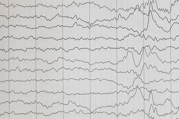 gehirn wave - eeg epilepsy science electrode stock-fotos und bilder