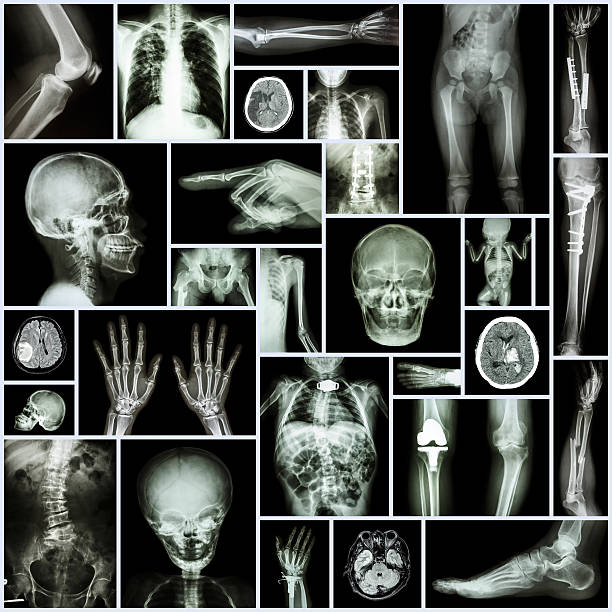 vários parte do homem, de cirurgia ortopédica e de várias doenças - cat scan pelvis hip human spine - fotografias e filmes do acervo