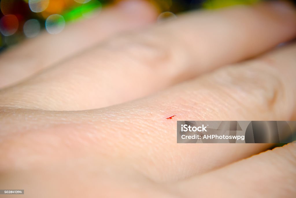 small cut on hand Tiny cut 2015 Stock Photo