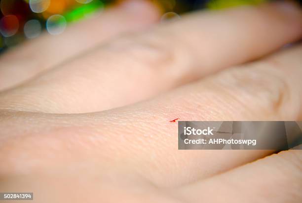 Small Cut On Hand Stock Photo - Download Image Now - 2015, Blood, Close-up