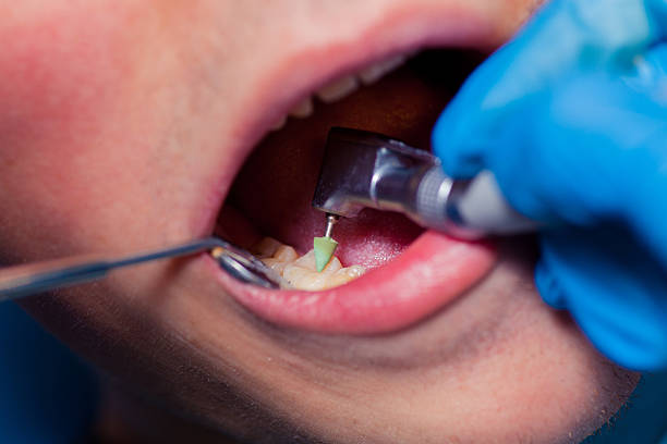 istock Dentist treatment a patient's teeth in the dentist 502920520