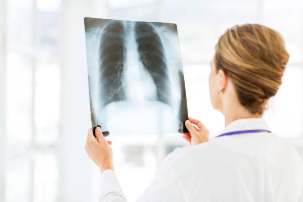istock Radiologist Examining Chest X-Ray In Hospital 502938143
