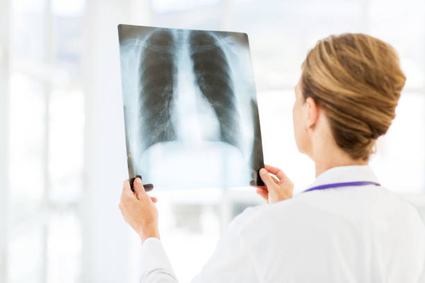 radiolog badanie rtg klatki piersiowej w szpitalu - rib cage people x ray image x ray zdjęcia i obrazy z banku zdjęć