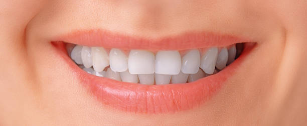 istock Female smile, close-up 502952641