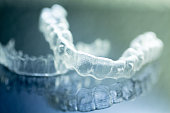 dental-aligners-zahn-klammern-unsichtbar