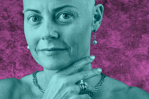 Woman standing up against cancer having chemotherapy, fighting for life. The woman looks thoughtful and believing in a future. Bald woman lost her hair during chemotherapy cure. Image is toned pink and cyan.