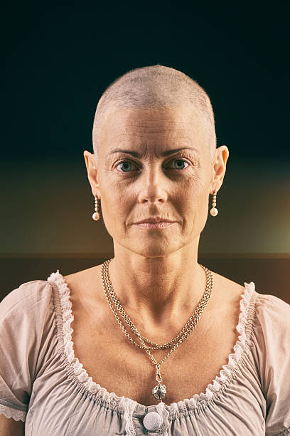 istock Serious woman in chemotherapy looking at camera 503482672