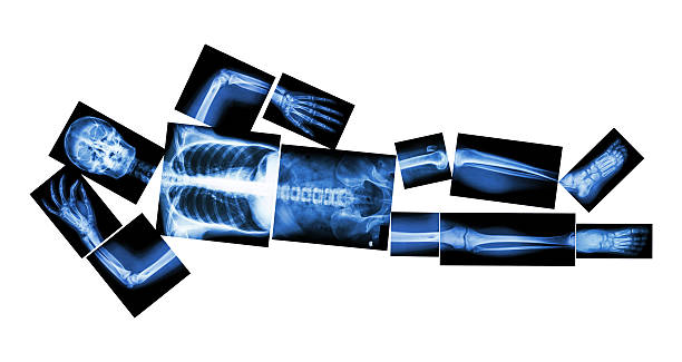x-ray intero corpo e notte - doctor brain x ray x ray image foto e immagini stock