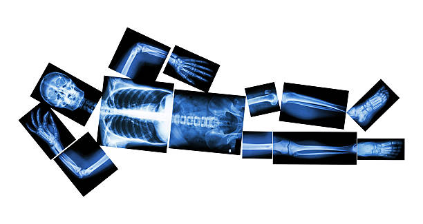 x-레이 전체 및 슬리핑 - human lung x ray image x ray human spine 뉴스 사진 이미지