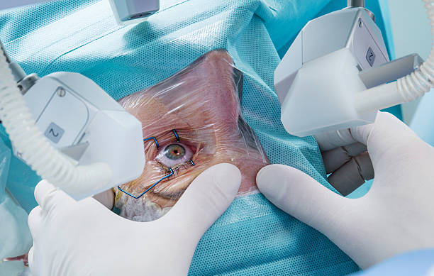 Laser surgery Woman with eye open in hospital under the laser machine eye surgery photos stock pictures, royalty-free photos & images