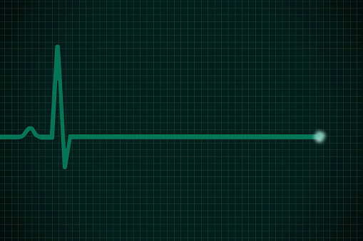 Digitally created green heartbeat monitor.