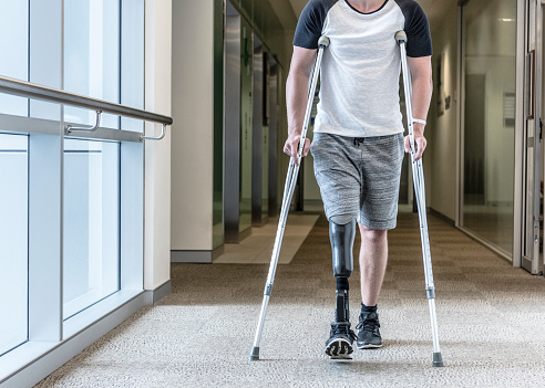 Male amputee with prosthesis walking in hospital. Man learning to walk again. Rehabilitation, recovery, determination.