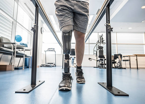 Man with prosthetic leg using parallel bars Male amputee with prosthesis using rehabilitation equipment. Man learning to walk again. Rehabilitation, recovery, determination, physiotherapy. recovery photos stock pictures, royalty-free photos & images