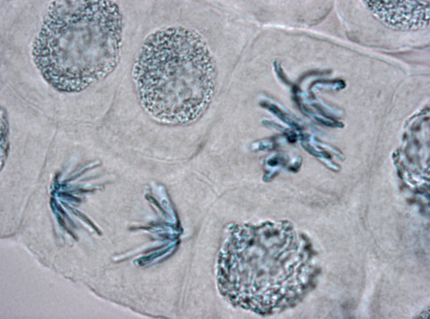 Squash preparation of stained onion root tip cells showing late telophase and metaphase stages of mitosis. Bright field illumination on a Leica microscope, Image taken with the X100 objective lens.  Depth of focus is extremely shallow (less than one micron).  Optimum setting of the aperture for maximum resolution and good contrast. Chromatic aberation is inevitable in light microscopy, especially at this scale of magnification, but has been kept to a minimum in this image.