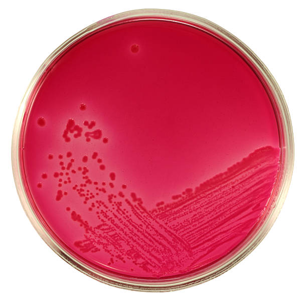 escherichia coli cresce em vermelho ágar endo isolado a branco - petri dish agar jelly laboratory glassware bacterium imagens e fotografias de stock