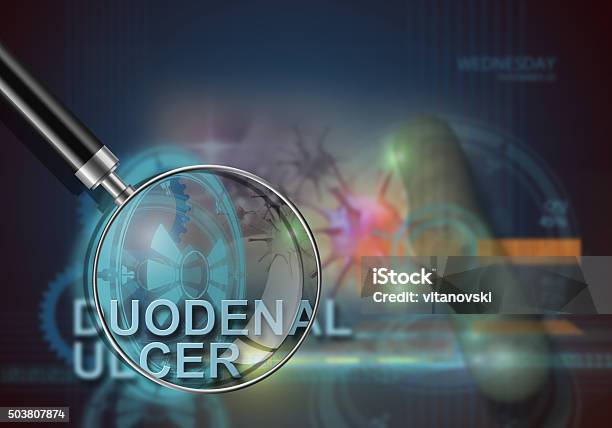 Duodenal Ulcer Stock Photo - Download Image Now - Abdomen, Abstract, Amebiasis