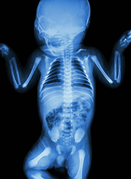 film x-ray whole infant's body film x-ray whole infant's body hip joint x stock pictures, royalty-free photos & images