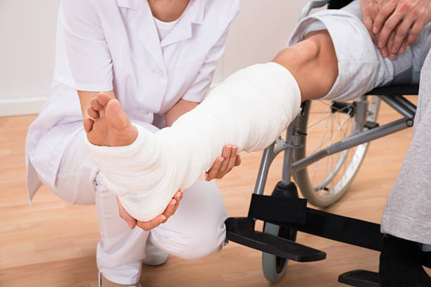 Female Doctor Holding Patient's Leg Close-up Of A Female Doctor Holding Disabled Patient's Leg broken leg stock pictures, royalty-free photos & images