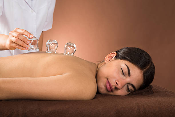 молодая женщина, получение cupping лечения - acupuncture cupping стоковые фото и изображения