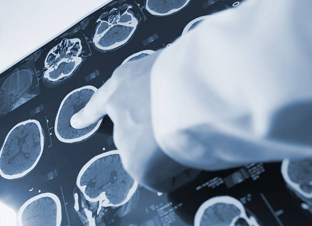 istock Doctor points finger at the scan picture 503992012
