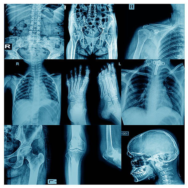 collezione x-ray "più parte dell'uomo - human lung x ray image x ray human spine foto e immagini stock