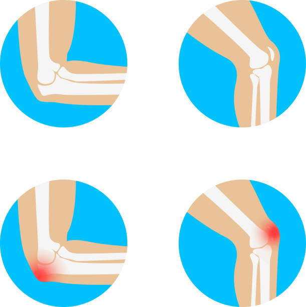 무릎, 팔꿈치 벡터 일러스트레이션. - cartilage patella human knee medical exam stock illustrations