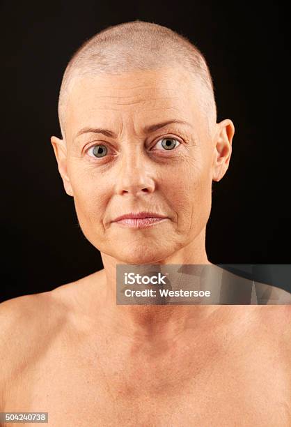 Woman With Cancer In Chemotherapy Stock Photo - Download Image Now - 40-44 Years, 40-49 Years, Adult