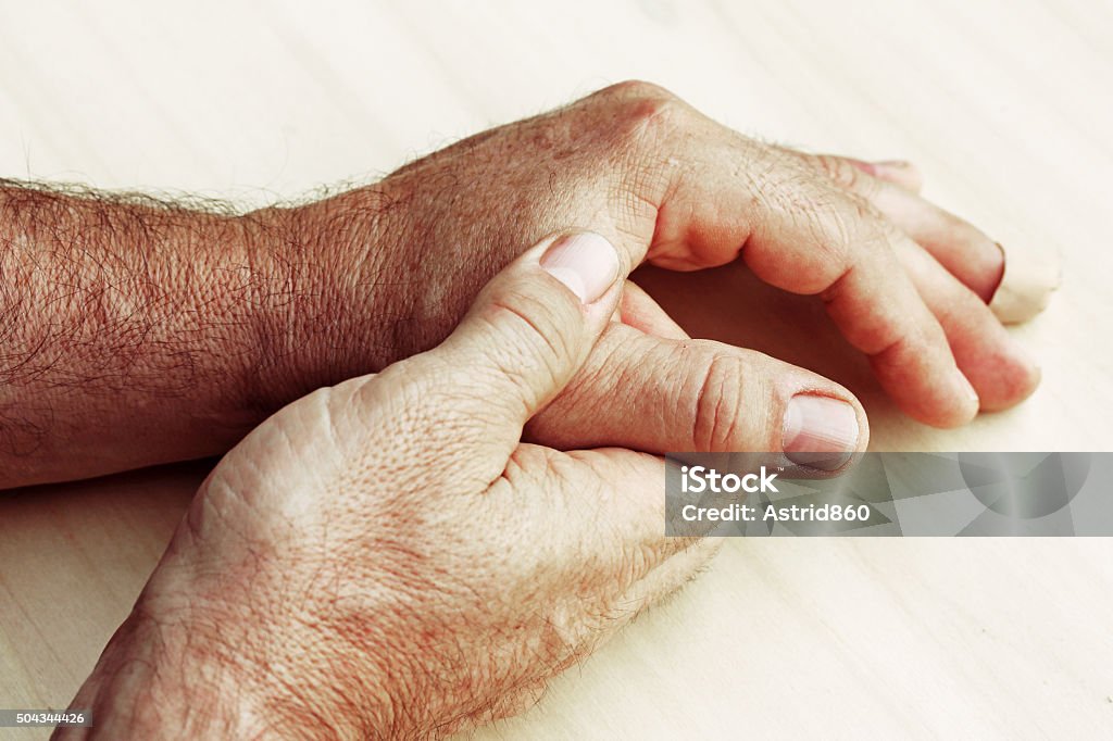 Vieil homme avec douleur à des doigts et des mains - Photo de Psoriasis libre de droits