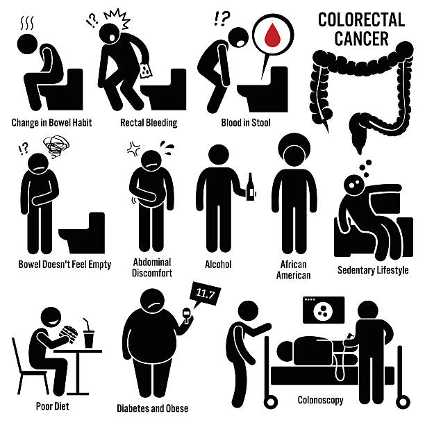 colon rectal colorectal krebs illustrationen - darmspiegelung stock-grafiken, -clipart, -cartoons und -symbole