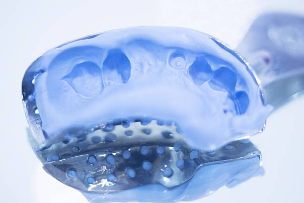 istock Dental prosthetics gel tooth mold 504491218