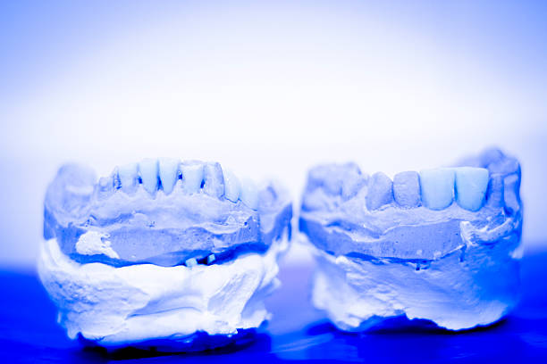 Dental prosthetics clay tooth mold in dentists photo.