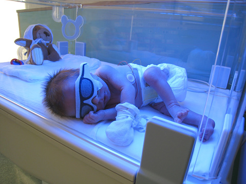 Newborn baby with neonatal jaundice and high bilirubin hyperbilirubinemia under blue UV light for phototheraphy
