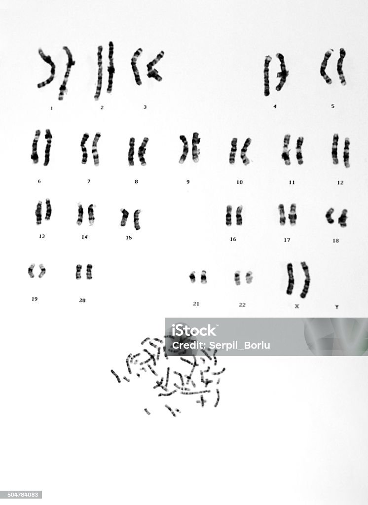 Human Chromosomes Chromosome Stock Photo