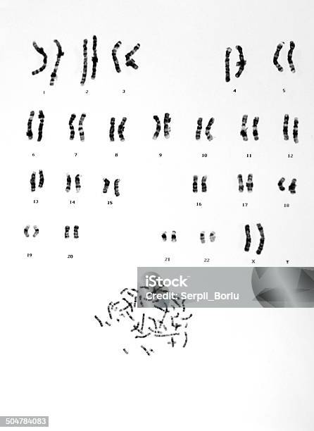 Human Chromosomes Stock Photo - Download Image Now - Chromosome, Karyotype, People