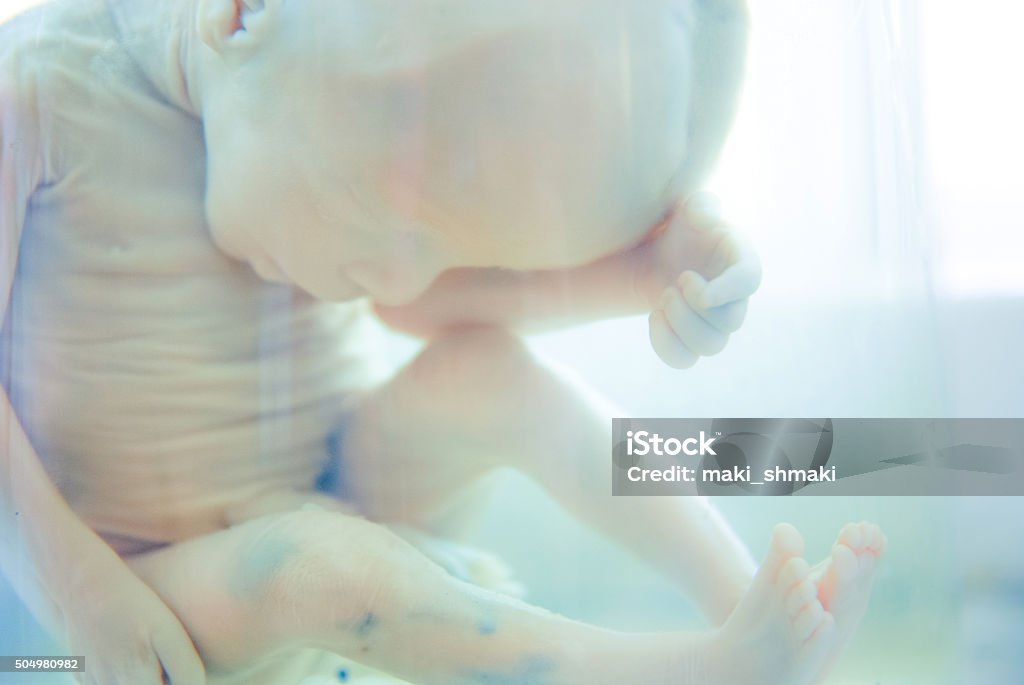 fetus in formalin solution Childbirth Stock Photo