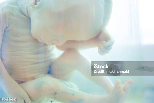 Fetus In Formalin Solution Stock Photo - Download Image Now - Childbirth, Eye, Fetus