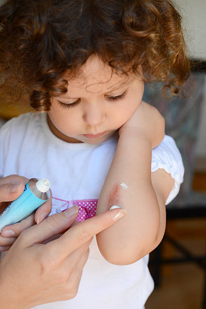 istock Little girl looking scrape on arm mother making cream 505248953