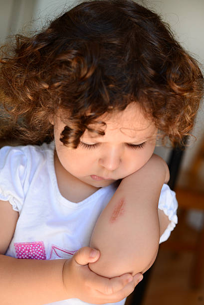 istock Little girl looking scrape on arm 505396899