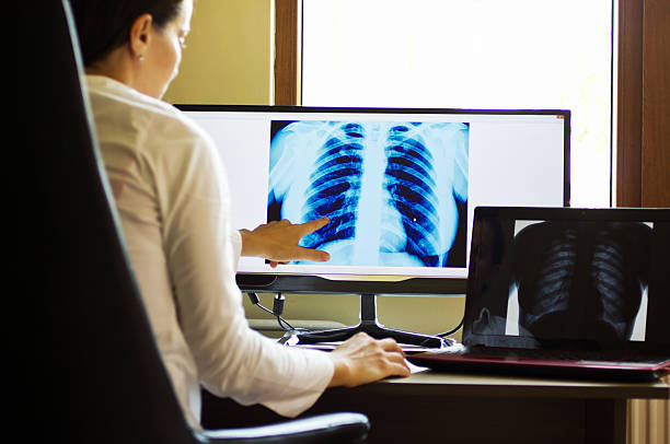 Doctor radiographer looking at x ray on computer screen Radiographer looking at x ray on computer screen . x ray results stock pictures, royalty-free photos & images