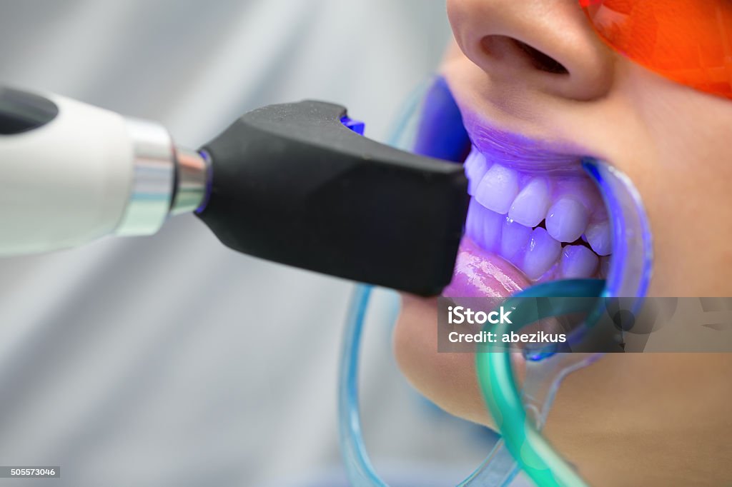 Tooth Filling Ultraviolet Lamp Stock Download Image - Whitening, Dentist, LED Light - iStock